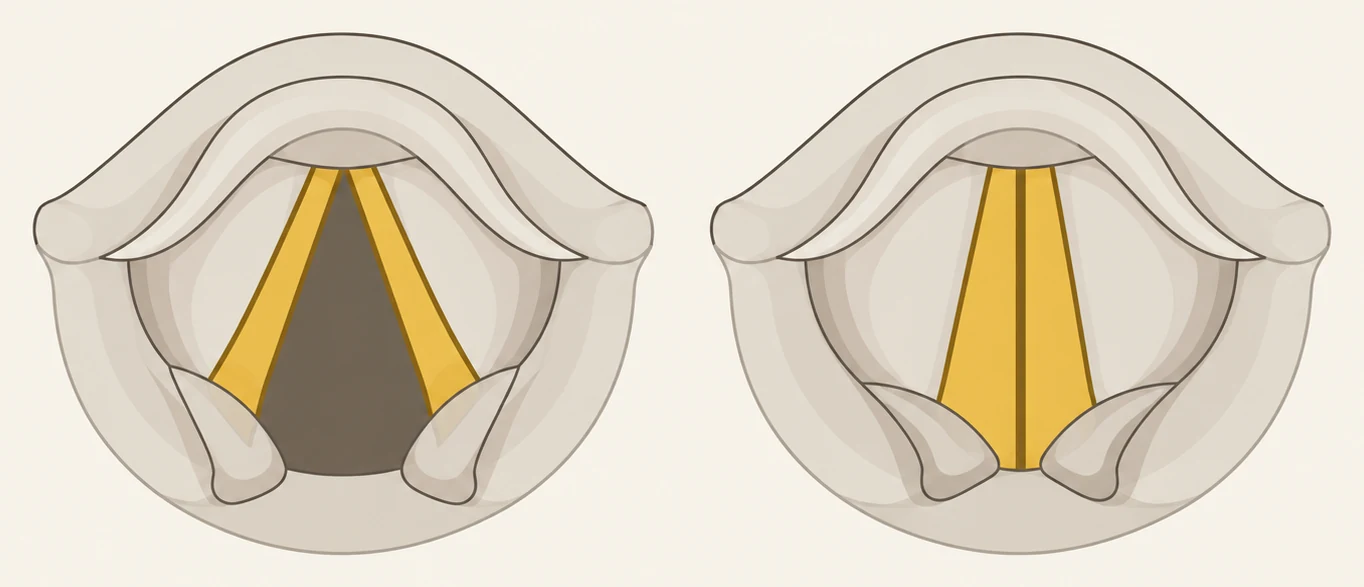 Kehlkopf von oben gezeichnet, zweimal. Links stehen die goldenen Stimmlippen als offenes V auseinander, rechts liegen sie aneinander.